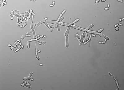 mikroszkópikus gombák férgek a gyomor tüneteiben